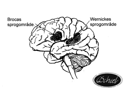 hjernen brain hjernen afasi Aphasia tegning drawing Charlotte Scheel